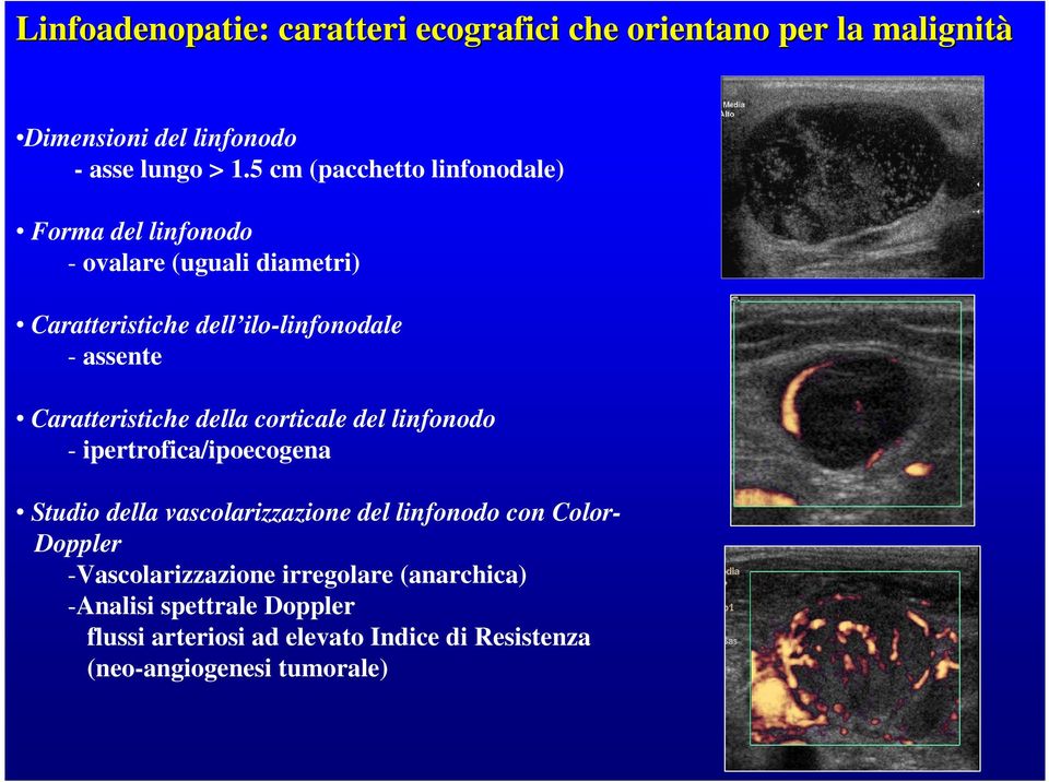 Caratteristiche della corticale del linfonodo - ipertrofica/ipoecogena Studio della vascolarizzazione del linfonodo con Color-