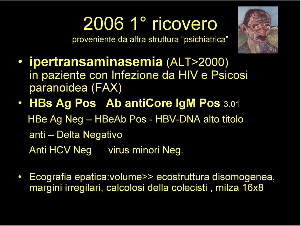 01 HBe Ag Neg HBeAb Pos - HBV-DNA alto titolo anti Delta Negativo Anti HCV Neg virus minori Neg.