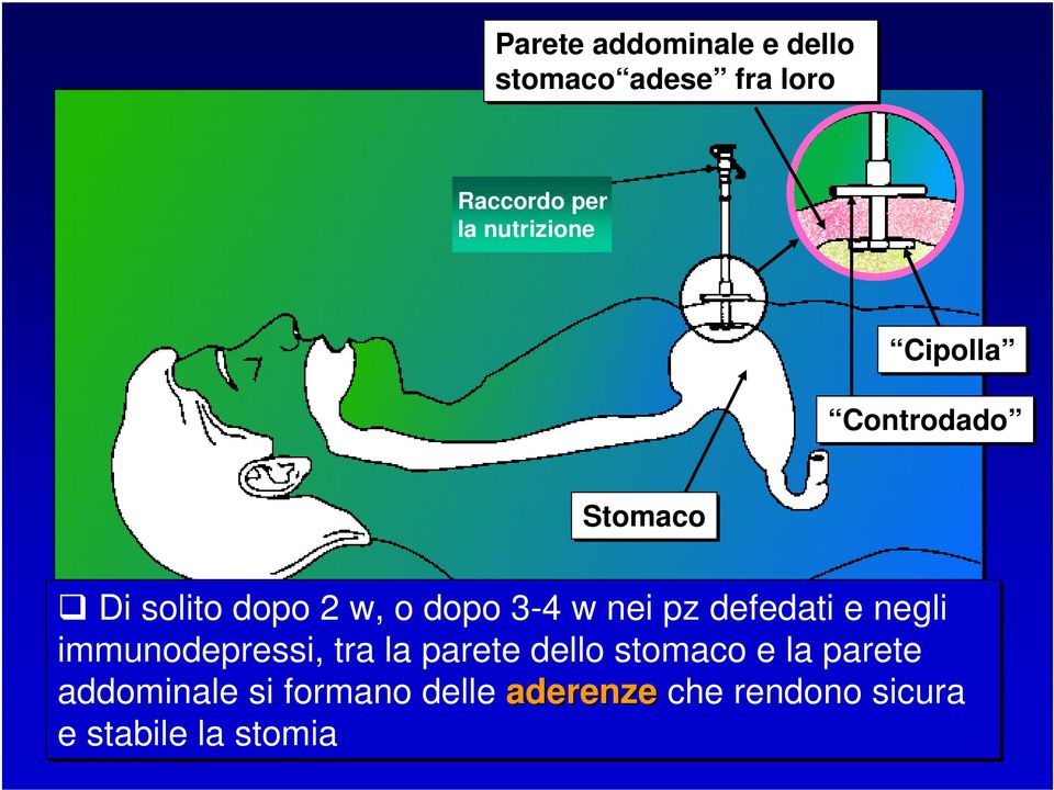 nei pz defedati e negli immunodepressi, tra la parete dello stomaco e la