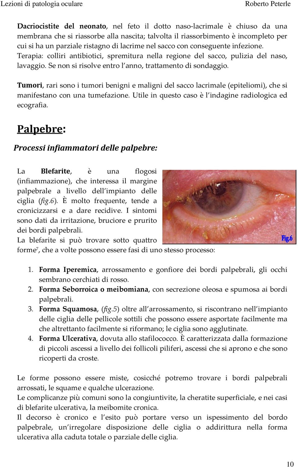 Tumori, rari sono i tumori benigni e maligni del sacco lacrimale (epiteliomi), che si manifestano con una tumefazione. Utile in questo caso è l indagine radiologica ed ecografia.