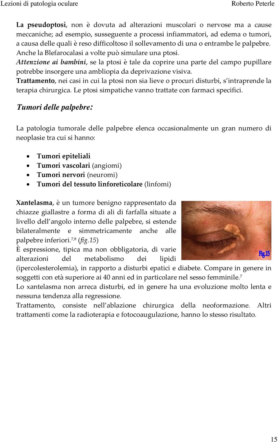 Attenzione ai bambini, se la ptosi è tale da coprire una parte del campo pupillare potrebbe insorgere una ambliopia da deprivazione visiva.