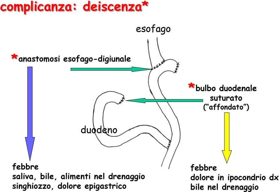 duodeno febbre saliva, bile, alimenti nel drenaggio