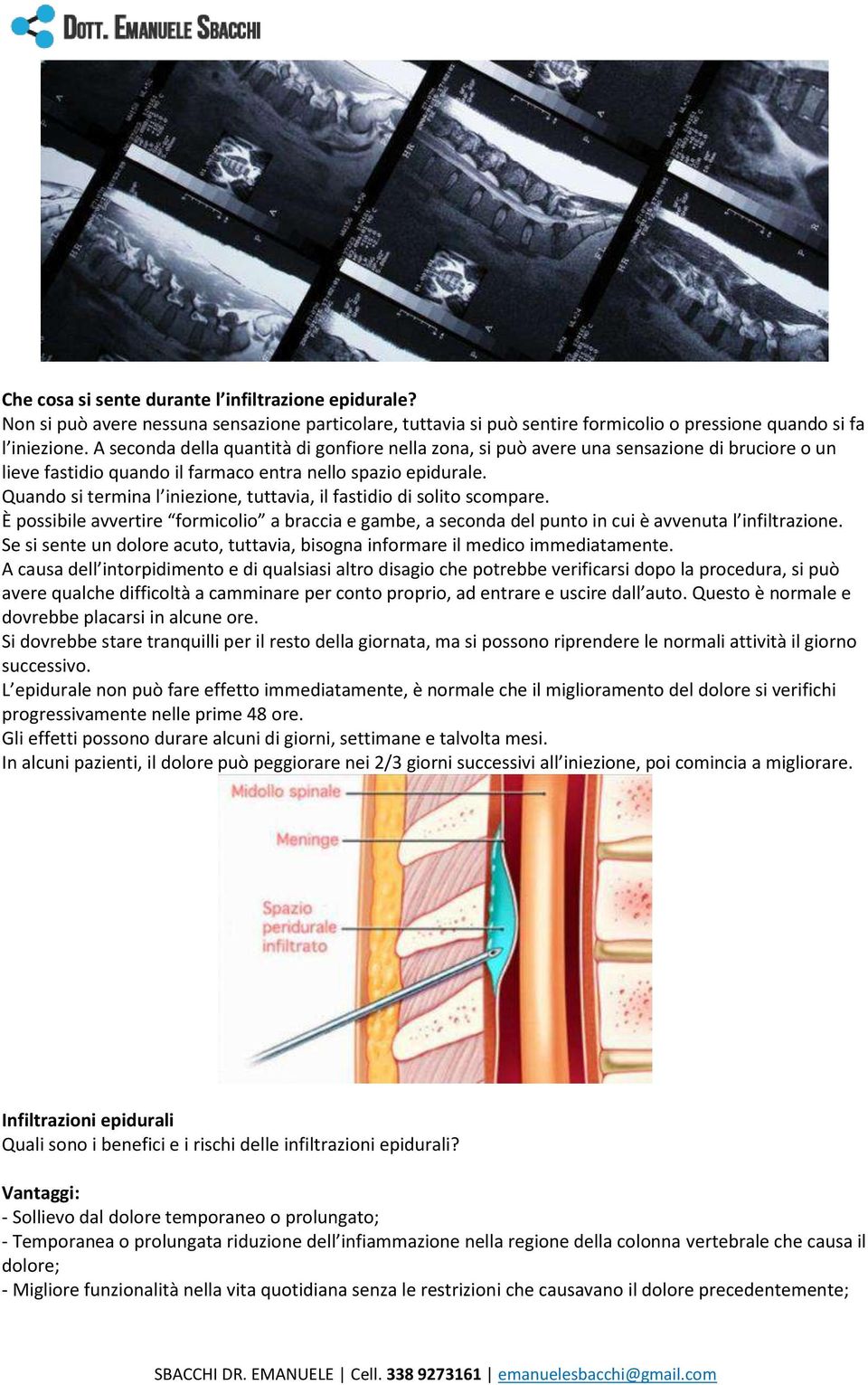 Quando si termina l iniezione, tuttavia, il fastidio di solito scompare. È possibile avvertire formicolio a braccia e gambe, a seconda del punto in cui è avvenuta l infiltrazione.