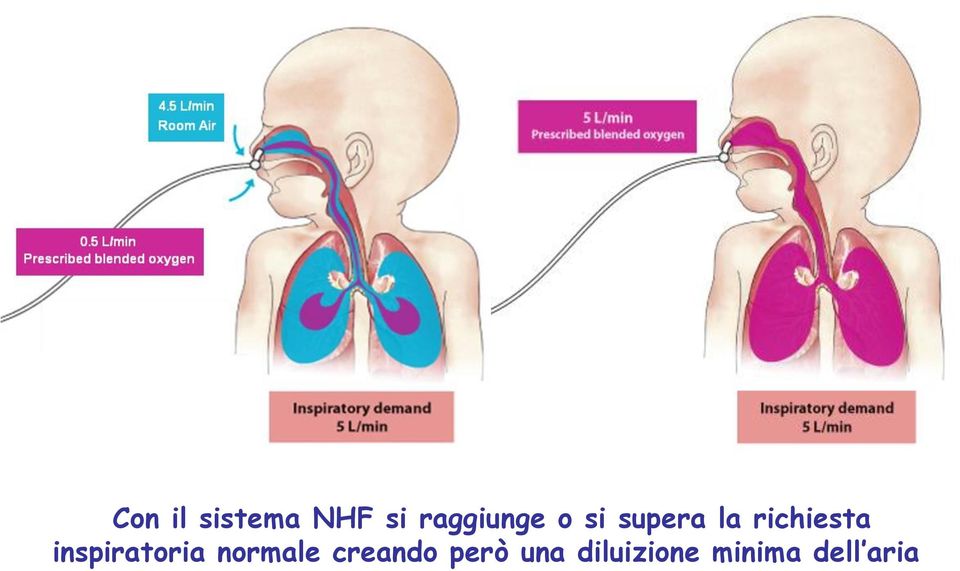 richiesta inspiratoria normale