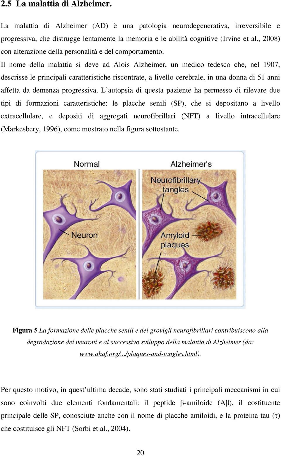 Il nome della malattia si deve ad Alois Alzheimer, un medico tedesco che, nel 1907, descrisse le principali caratteristiche riscontrate, a livello cerebrale, in una donna di 51 anni affetta da