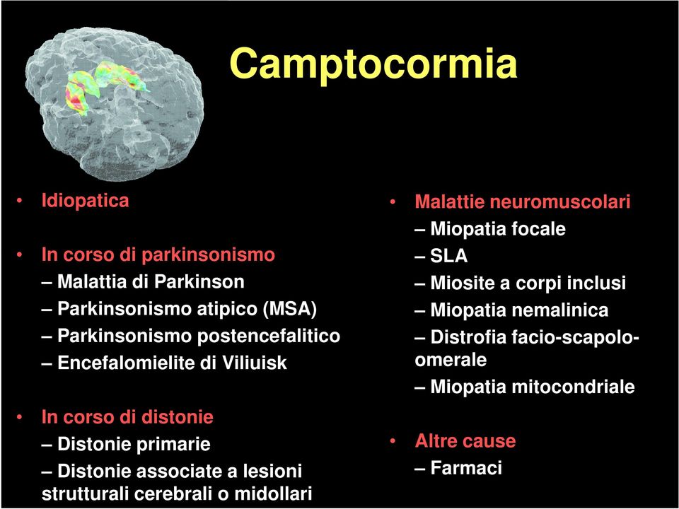 Distonie associate a lesioni strutturali cerebrali o midollari Malattie neuromuscolari Miopatia focale