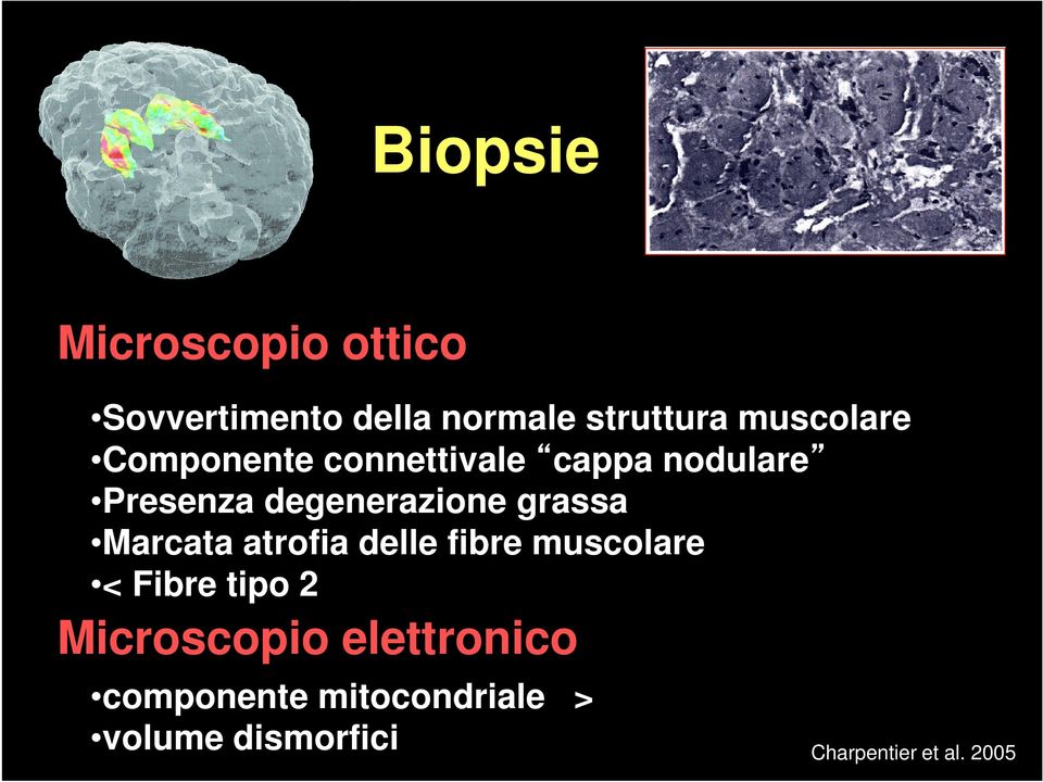 atrofia delle fibre muscolare < Fibre tipo 2 Microscopio elettronico componente