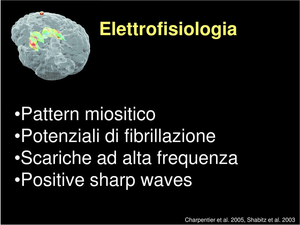 alta frequenza Positive sharp waves