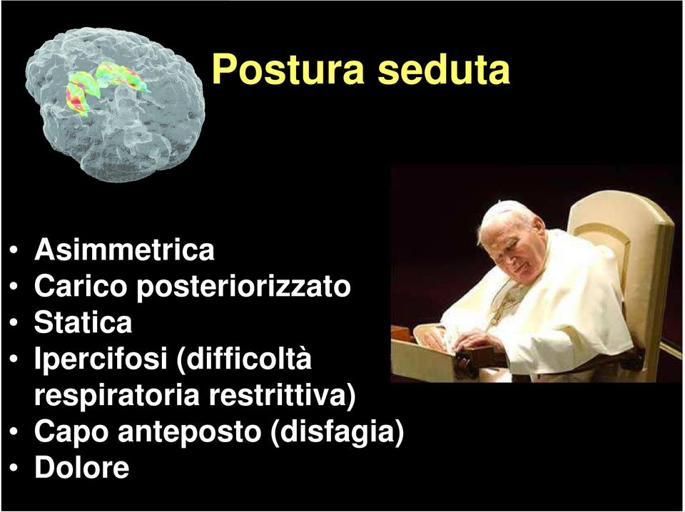 Statica Ipercifosi (difficoltà