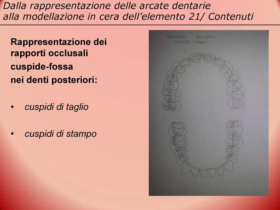 rapporti occlusali cuspide-fossa nei