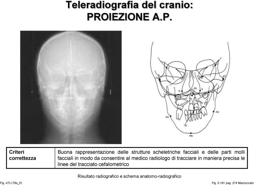 Criteri correttezza Buona rappresentazione delle strutture scheletriche facciali e delle