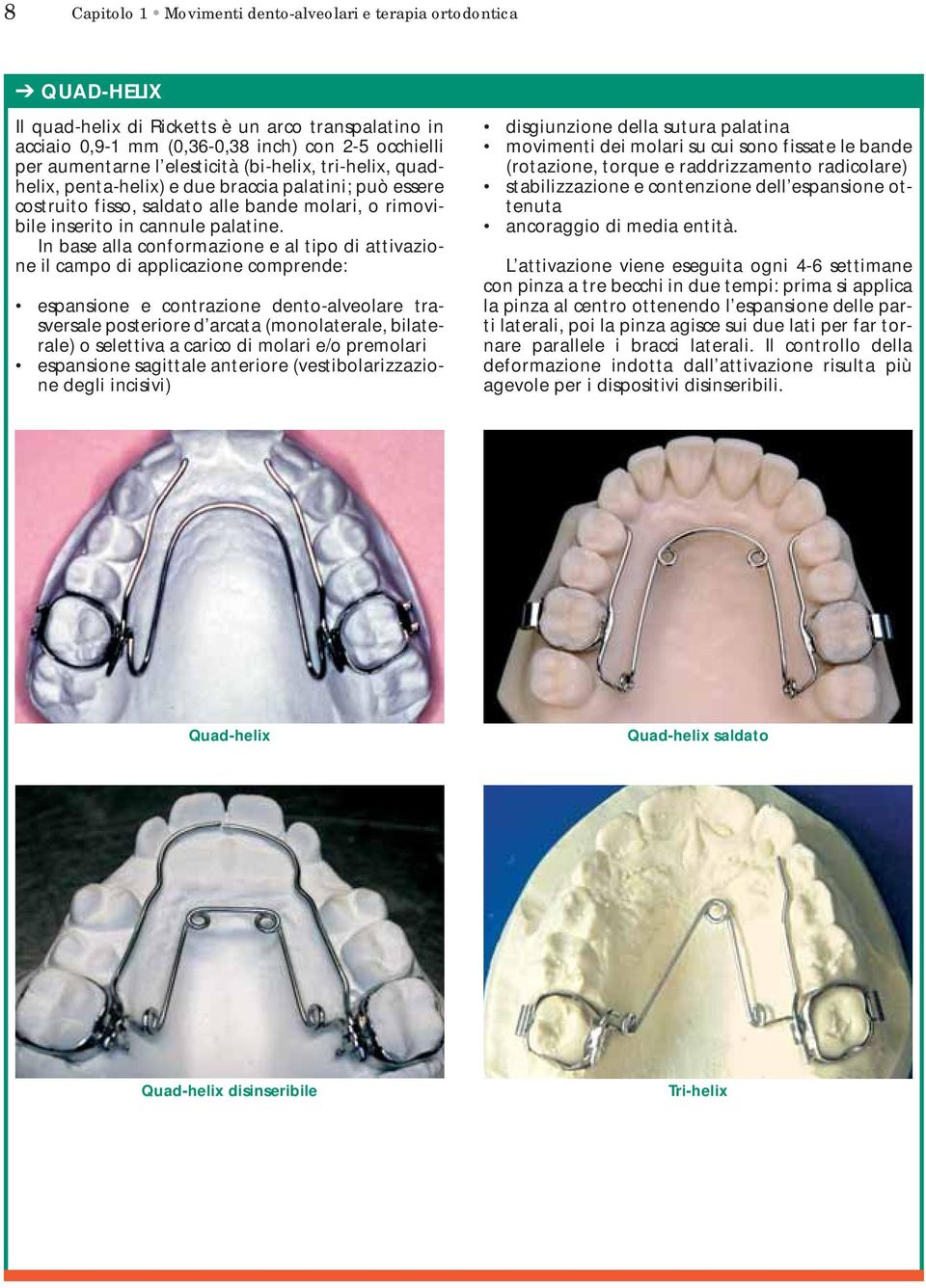 In base alla conformazione e al tipo di attivazione il campo di applicazione comprende: espansione e contrazione dento-alveolare trasversale posteriore d arcata (monolaterale, bilaterale) o selettiva
