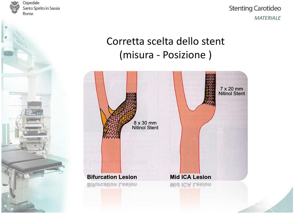 stent (misura