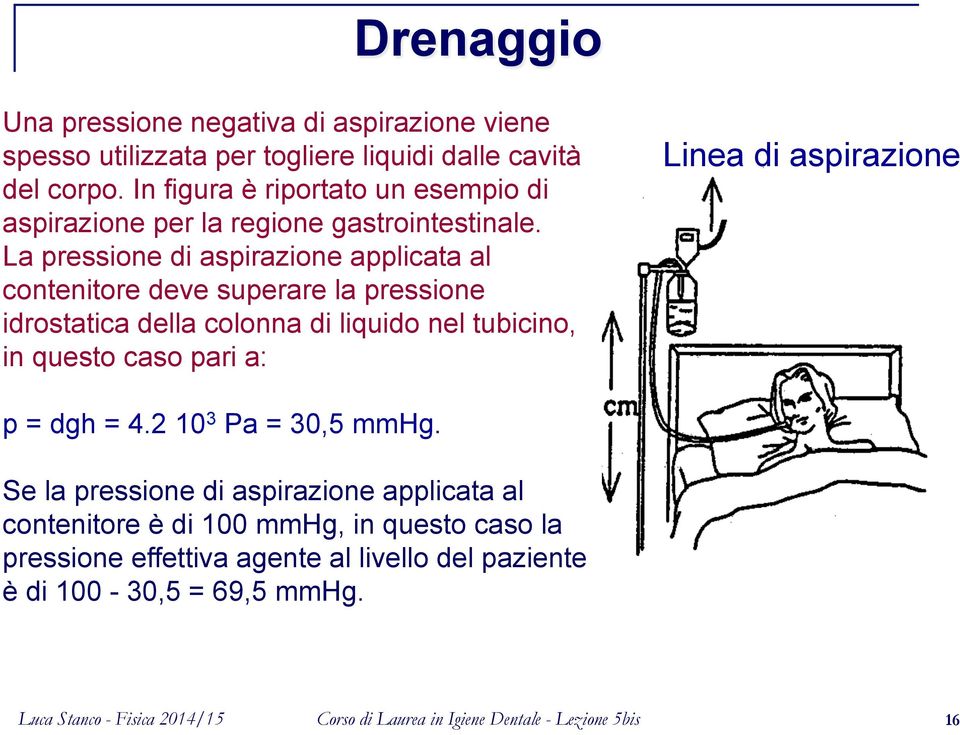 La pressione di aspirazione applicata al contenitore deve superare la pressione idrostatica della colonna di liquido nel tubicino, in questo