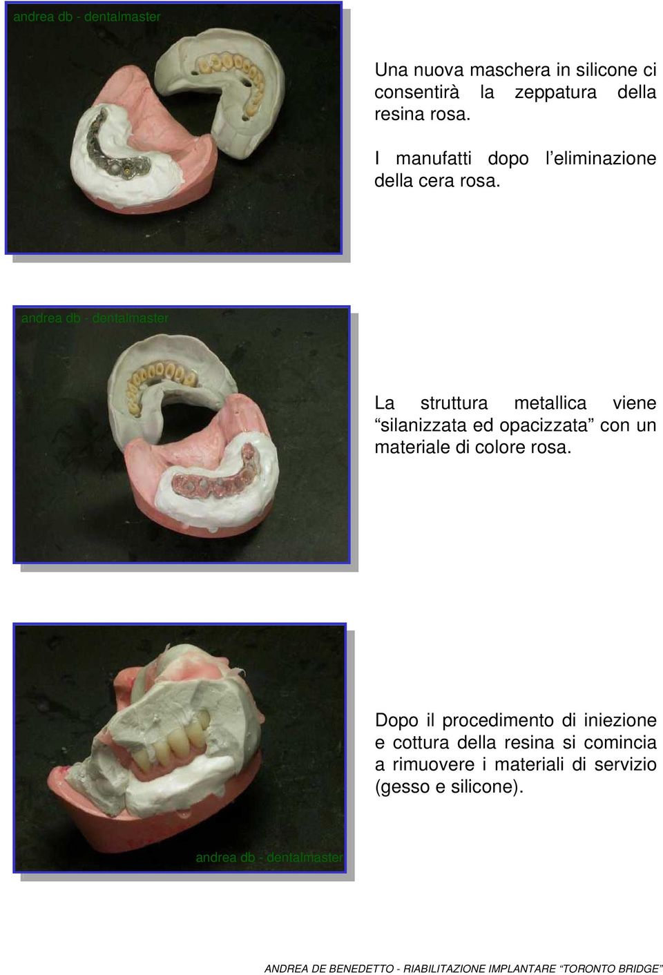 La struttura metallica viene silanizzata ed opacizzata con un materiale di colore