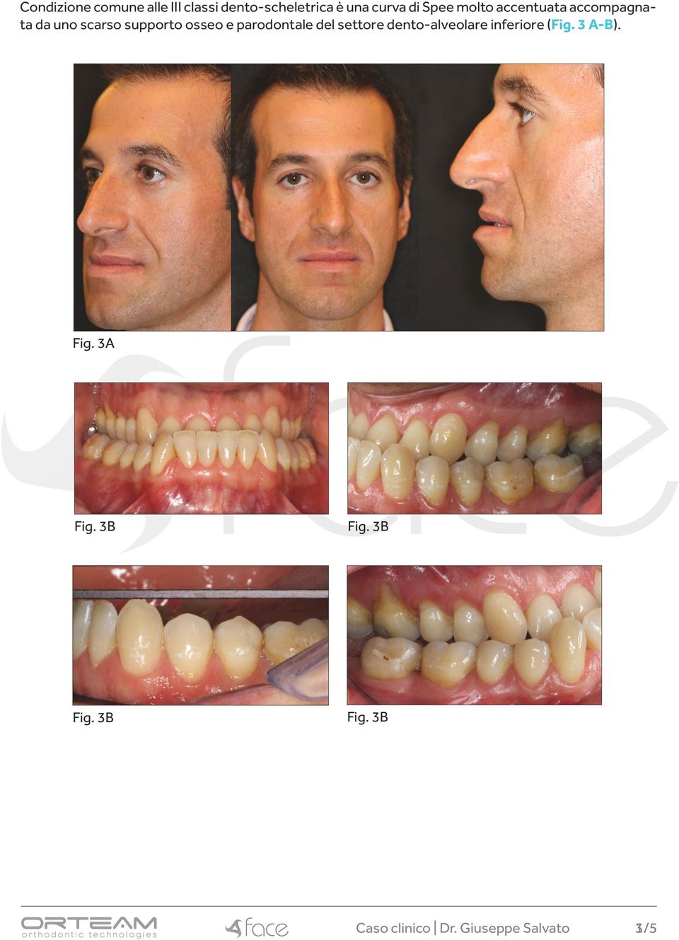 supporto osseo e parodontale del settore dento-alveolare