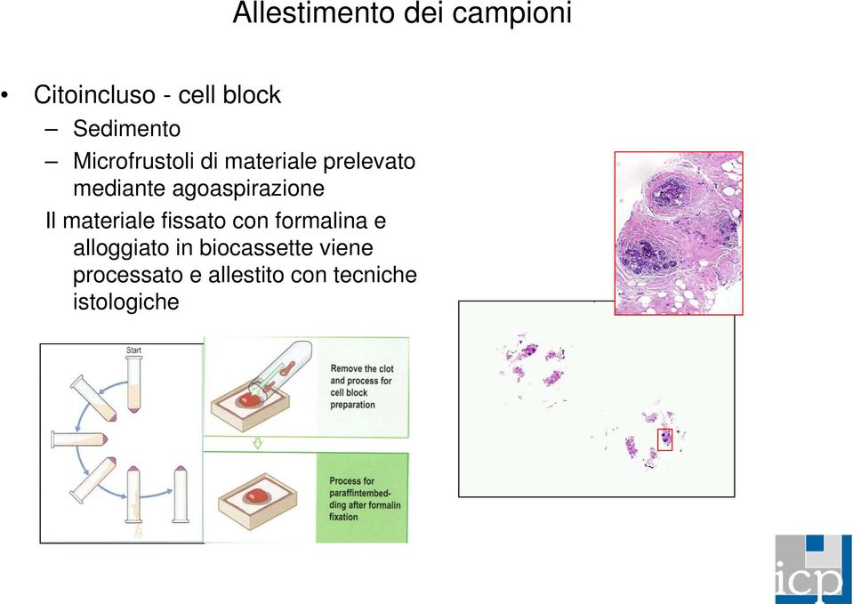 agoaspirazione Il materiale fissato con formalina e