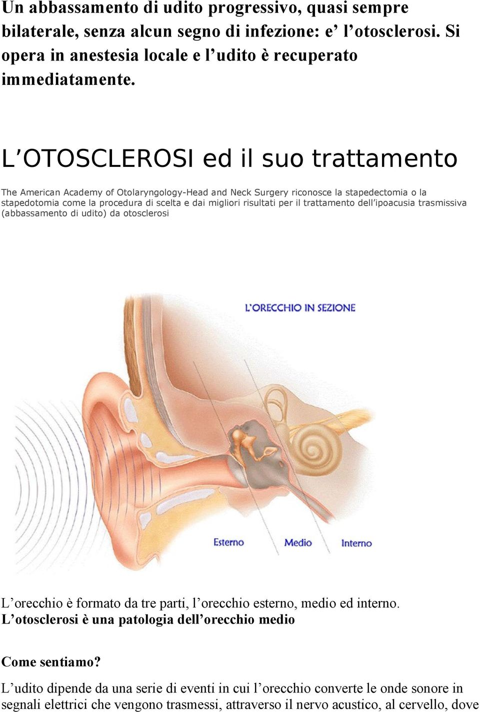 risultati per il trattamento dell ipoacusia trasmissiva (abbassamento di udito) da otosclerosi L orecchio è formato da tre parti, l orecchio esterno, medio ed interno.