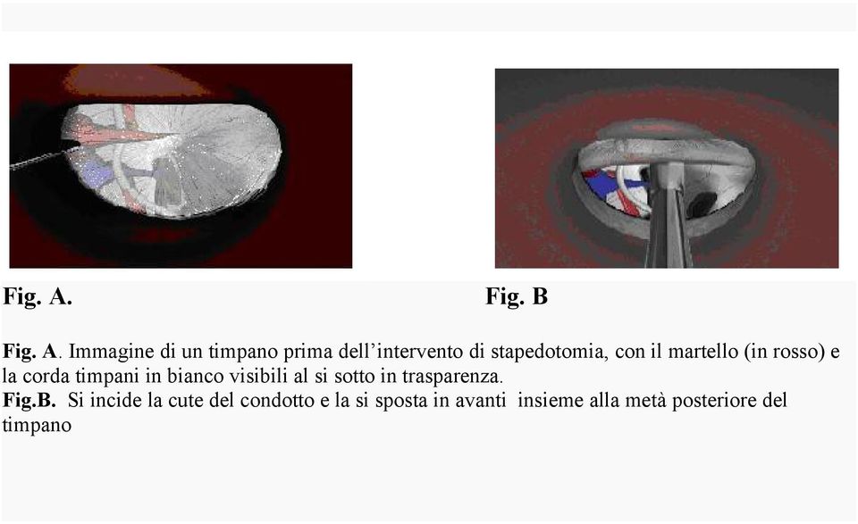 con il martello (in rosso) e la corda timpani in bianco visibili al si