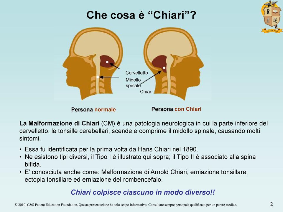 cerebellari, scende e comprime il midollo spinale, causando molti sintomi. Essa fu identificata per la prima volta da Hans Chiari nel 1890.