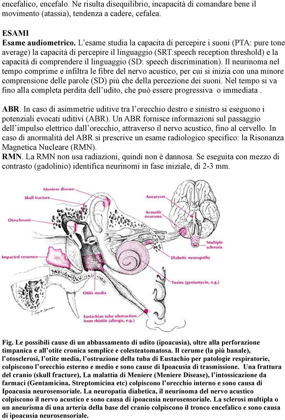 discrimination). Il neurinoma nel tempo comprime e infiltra le fibre del nervo acustico, per cui si inizia con una minore comprensione delle parole (SD) più che della percezione dei suoni.