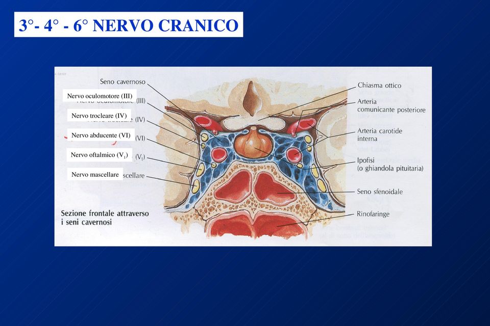 trocleare (IV) Nervo abducente