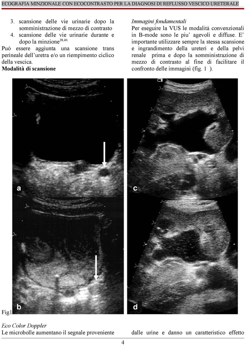 Modalità di scansione Immagini fondamentali Per eseguire la VUS le modalità convenzionali in B-mode sono le piu agevoli e diffuse.