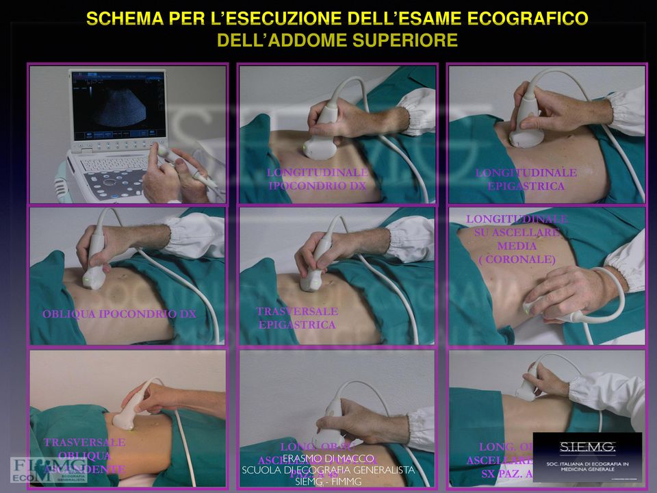 DX TRASVERSALE EPIGASTRICA TRASVERSALE OBLIQUA ASCENDENTE LONG. OB.SU ASCELLARE ERASMO DI POST.