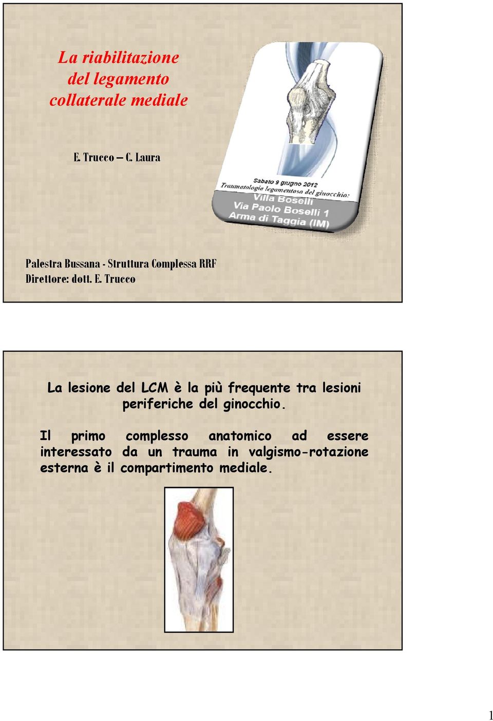 Trucco La lesione del LCM è la più frequente tra lesioni periferiche del ginocchio.