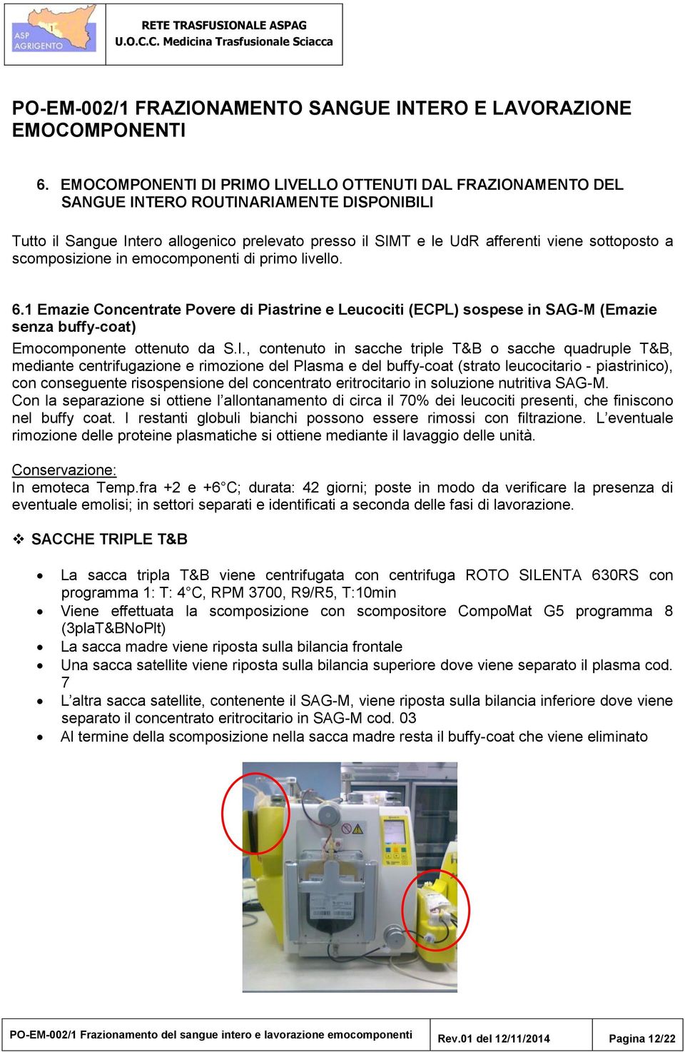 , contenuto in sacche triple T&B o sacche quadruple T&B, mediante centrifugazione e rimozione del Plasma e del buffy-coat (strato leucocitario - piastrinico), con conseguente risospensione del