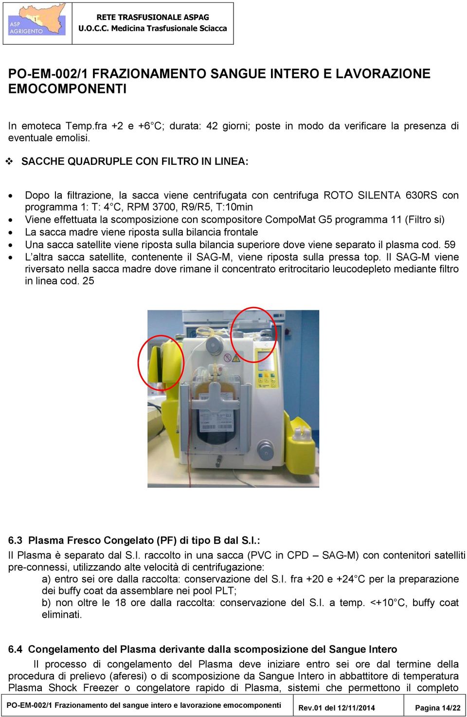 scomposizione con scompositore CompoMat G5 programma 11 (Filtro si) La sacca madre viene riposta sulla bilancia frontale Una sacca satellite viene riposta sulla bilancia superiore dove viene separato