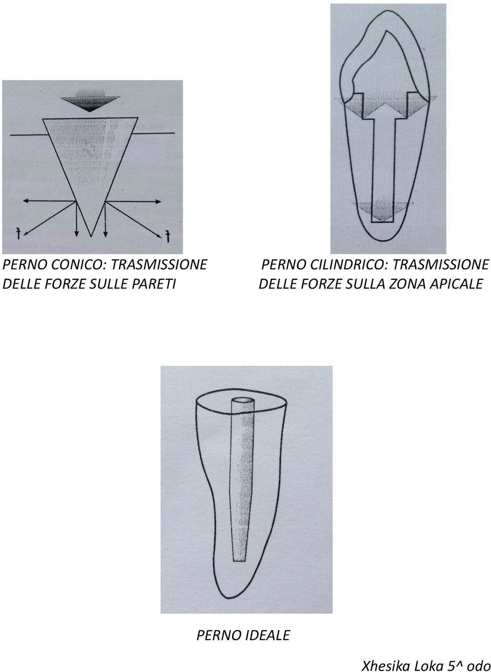 TRASMISSIONE DELLE FORZE SULLA ZONA