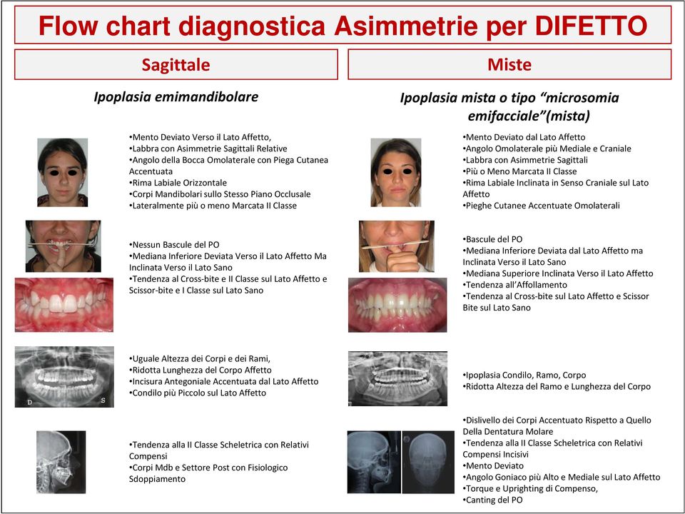 Deviato dal Lato Affetto Angolo Omolaterale più Mediale e Craniale Labbra con Asimmetrie Sagittali Più o Meno Marcata II Classe Rima Labiale Inclinata in Senso Craniale sul Lato Affetto Pieghe