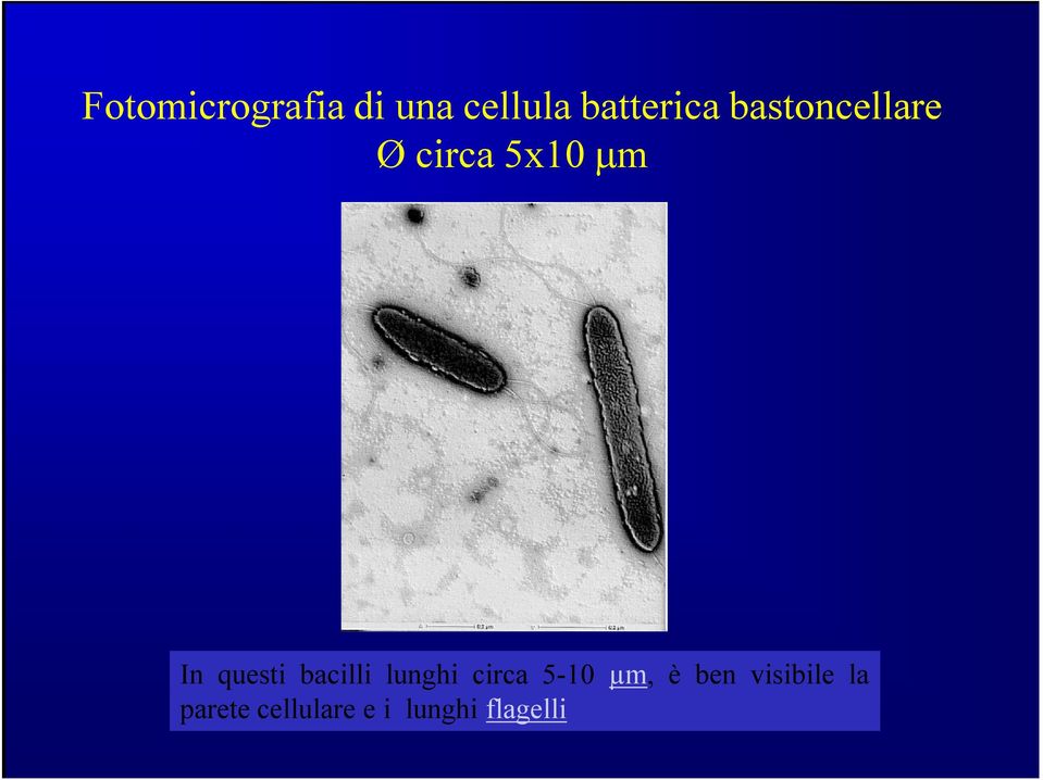 bacilli lunghi circa 5-10 µm, è ben