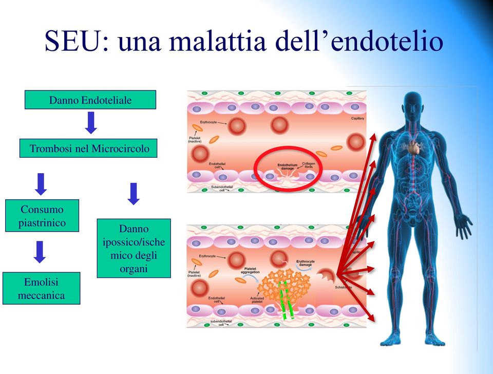 Consumo piastrinico Emolisi meccanica