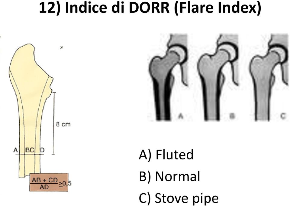 Index) A) Fluted