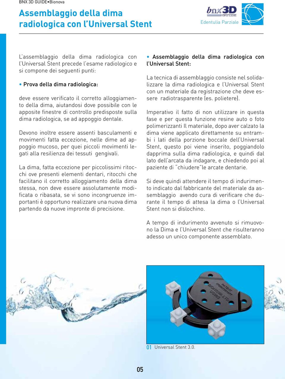 appoggio dentale. Devono inoltre essere assenti basculamenti e movimenti fatta eccezione, nelle dime ad appoggio mucoso, per quei piccoli movimenti legati alla resilienza dei tessuti gengivali.