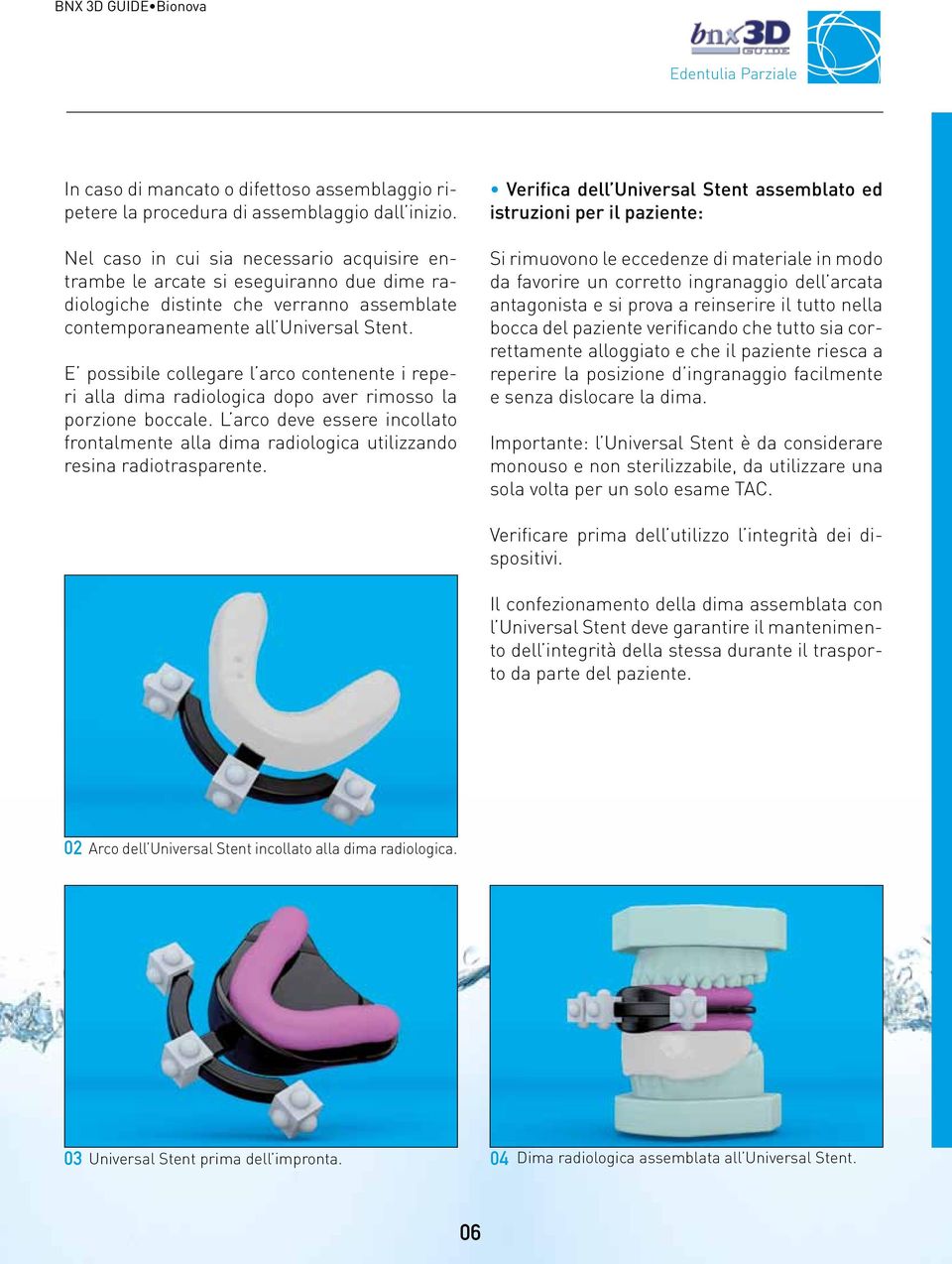 E possibile collegare l arco contenente i reperi alla dima radiologica dopo aver rimosso la porzione boccale.