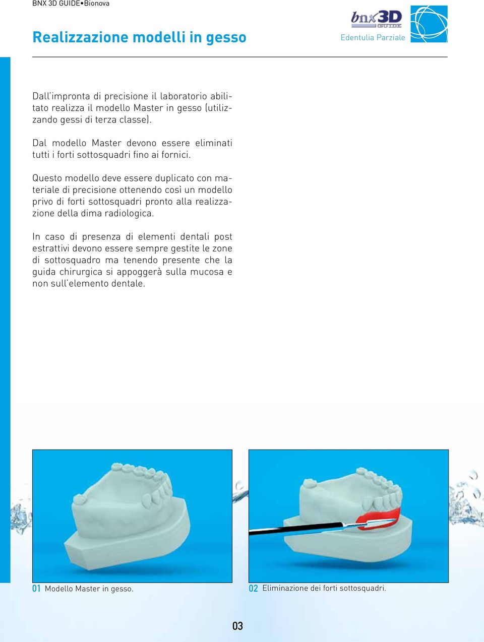 Questo modello deve essere duplicato con materiale di precisione ottenendo così un modello privo di forti sottosquadri pronto alla realizzazione della dima radiologica.