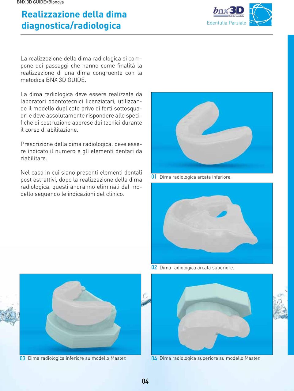 La dima radiologica deve essere realizzata da laboratori odontotecnici licenziatari, utilizzando il modello duplicato privo di forti sottosquadri e deve assolutamente rispondere alle specifiche di