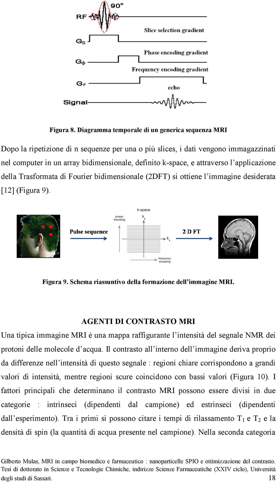 attraverso l applicazione della Trasformata di Fourier bidimensionale (2DFT) si ottiene l immagine desiderata [12] (Figura 9). Figura 9. Schema riassuntivo della formazione dell immagine MRI.