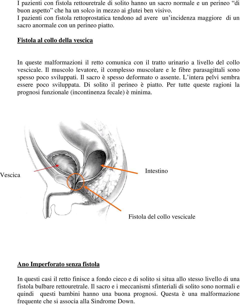 Fistola al collo della vescica In queste malformazioni il retto comunica con il tratto urinario a livello del collo vescicale.