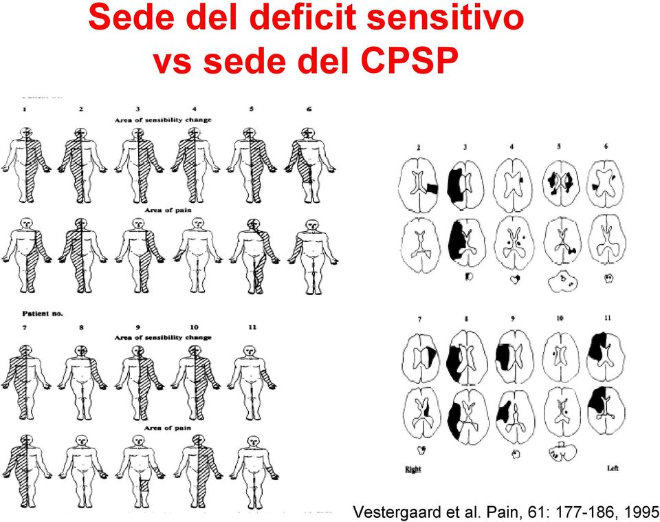 CPSP Vestergaard et