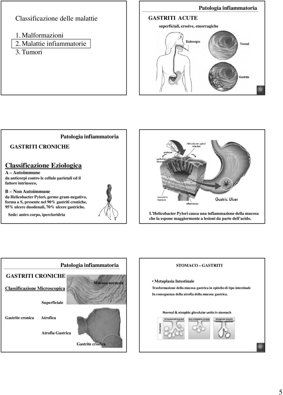 parietali ed il fattore intrinseco, B Non Autoimmune da Helicobacter Pylori, germe gram-negativo, forma a S, presente nel 90% gastriti croniche, 95% ulcere duodenali, 70% ulcere gastriche.