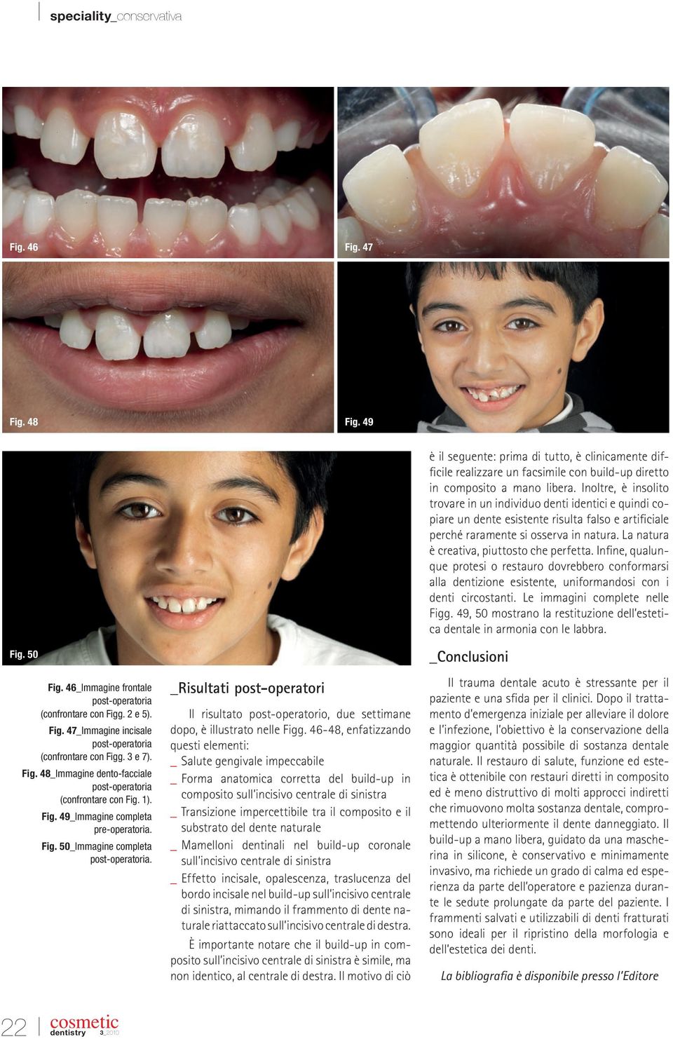 La natura è creativa, piuttosto che perfetta. Infine, qualunque protesi o restauro dovrebbero conformarsi alla dentizione esistente, uniformandosi con i denti circostanti.