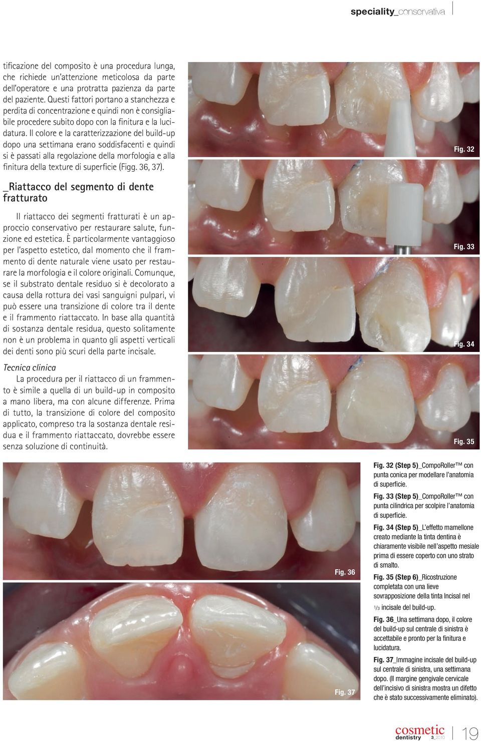 Il colore e la caratterizzazione del build-up dopo una settimana erano soddisfacenti e quindi si è passati alla regolazione della morfologia e alla finitura della texture di superficie (Figg. 36, 37).