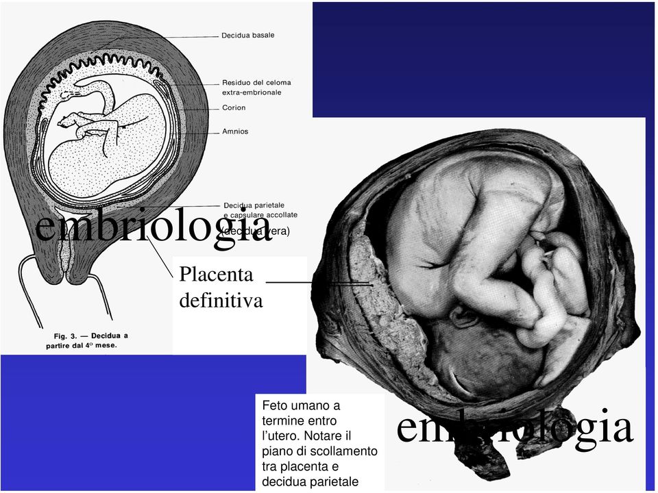 entro l utero.