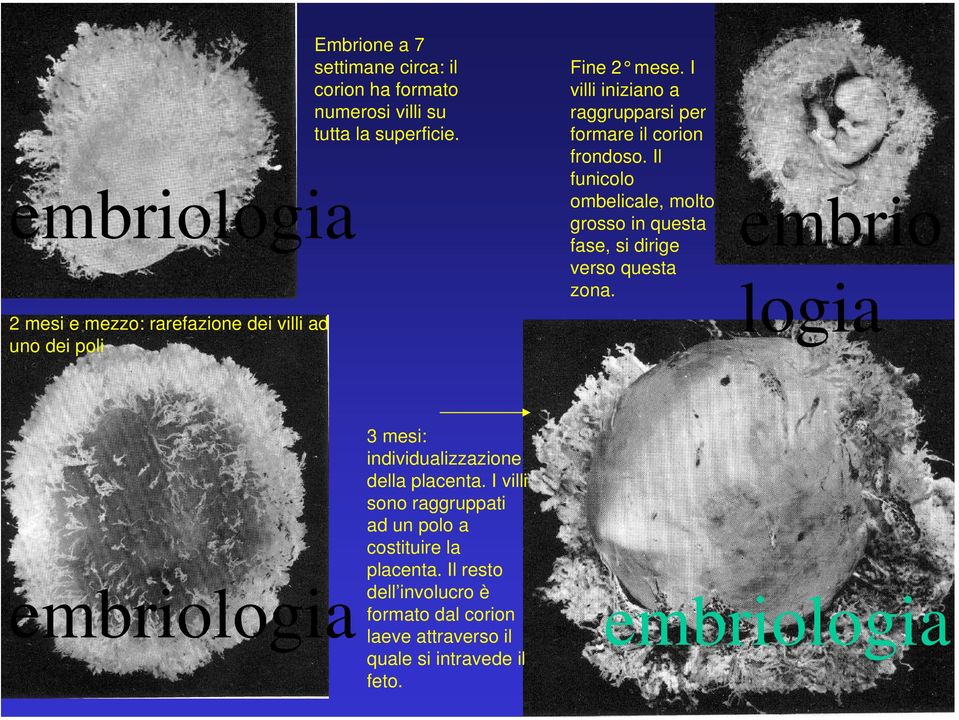 Il funicolo ombelicale, molto grosso in questa fase, si dirige verso questa zona.