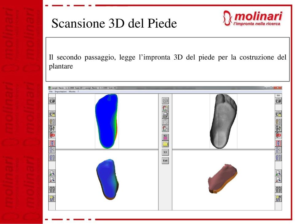 impronta 3D del piede per