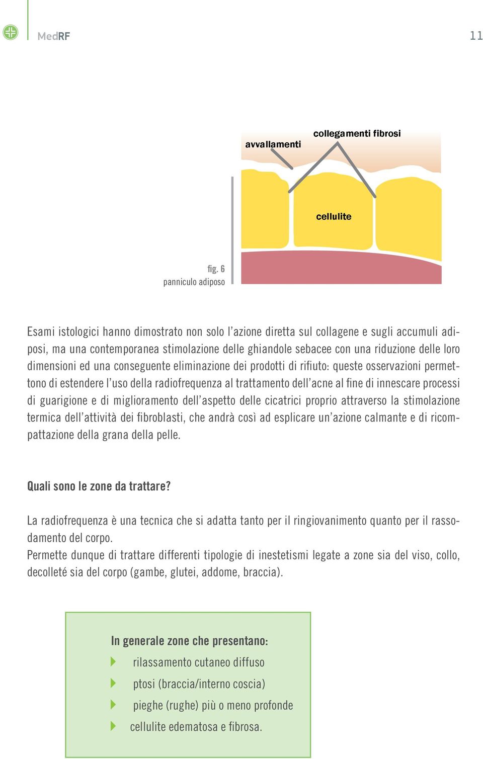 delle loro dimensioni ed una conseguente eliminazione dei prodotti di rifiuto: queste osservazioni permettono di estendere l uso della radiofrequenza al trattamento dell acne al fine di innescare